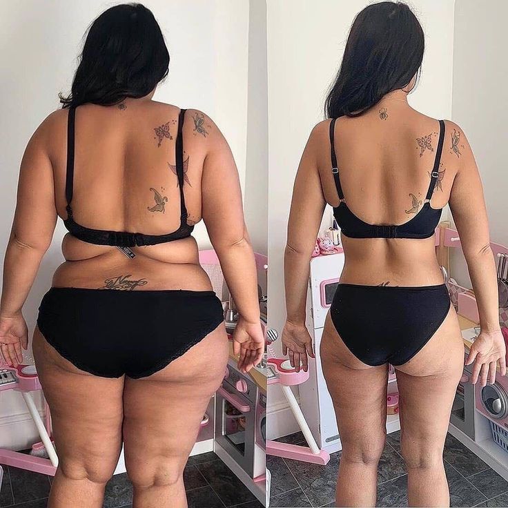 before and after weightloss